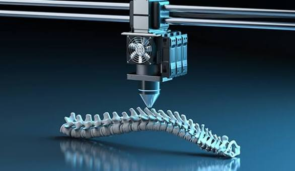 3D Printing in Metal