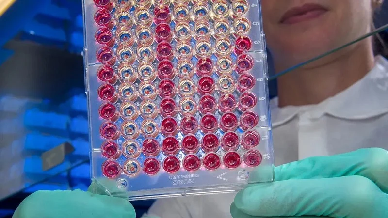 Core Assay Processes for Immunoassay Analyzer Parts